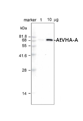 western blot detection using anti-V-ATPase antibodies 